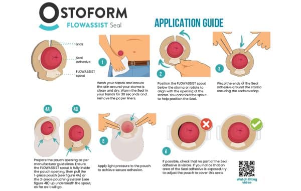 Ostoform Flowassist Seal | OFA-L Large 30mm - 40mm | Box of 10