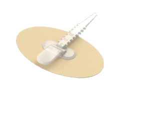 Bioderm CathGrip Catheter and Tube Securement System | XS | Single Strap | BIO 51023NSNWCA | Box of 30 Bioderm CathGrip Catheter and Tube Securement System | XS | Single Strap | BIO 51023NSNWCA | Box of 30