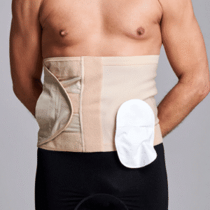 CUI Wear Unisex Adjustable Hole Anti Roll Ostomy Hernia Support Belt | XX-Large 10" Deep | Beige Left Sided | F933XXL | 1 Item